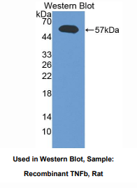 https://msimg.bioon.com/bionline/goods-no-pic.png