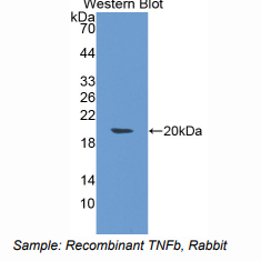 兔肿瘤坏死因子β(TNFb)多克隆抗体