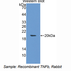 https://msimg.bioon.com/bionline/goods-no-pic.png