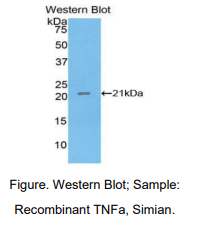 https://msimg.bioon.com/bionline/goods-no-pic.png