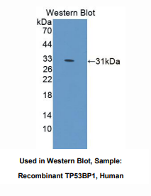 https://msimg.bioon.com/bionline/goods-no-pic.png