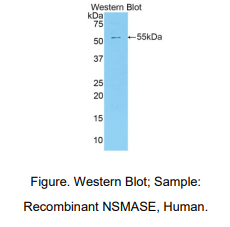 人中性鞘磷脂酶(NSMASE)多克隆抗体