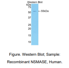 https://msimg.bioon.com/bionline/goods-no-pic.png