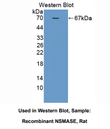 https://msimg.bioon.com/bionline/goods-no-pic.png