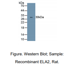 https://msimg.bioon.com/bionline/goods-no-pic.png