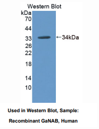 https://msimg.bioon.com/bionline/goods-no-pic.png