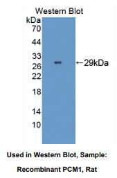 https://msimg.bioon.com/bionline/goods-no-pic.png