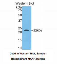 https://msimg.bioon.com/bionline/goods-no-pic.png