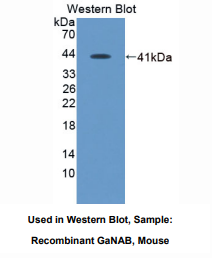 https://msimg.bioon.com/bionline/goods-no-pic.png