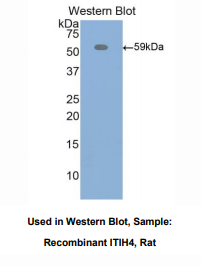 https://msimg.bioon.com/bionline/goods-no-pic.png