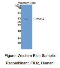 人中间α-球蛋白抑制因子H2(ITIH2)多克隆抗体