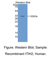 https://msimg.bioon.com/bionline/goods-no-pic.png