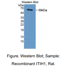 大鼠中间α-球蛋白抑制因子H1(ITIH1)多克隆抗体