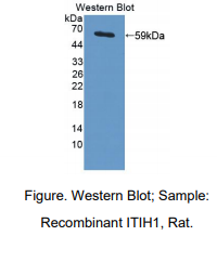 https://msimg.bioon.com/bionline/goods-no-pic.png