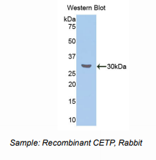 兔脂质转运蛋白(CETP)多克隆抗体