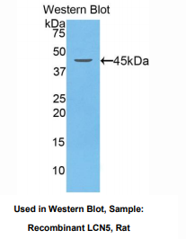 https://msimg.bioon.com/bionline/goods-no-pic.png