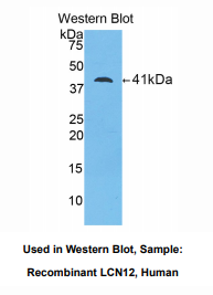 https://msimg.bioon.com/bionline/goods-no-pic.png