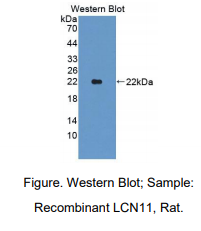 https://msimg.bioon.com/bionline/goods-no-pic.png