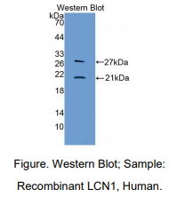 https://msimg.bioon.com/bionline/goods-no-pic.png