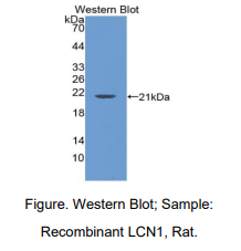 https://msimg.bioon.com/bionline/goods-no-pic.png