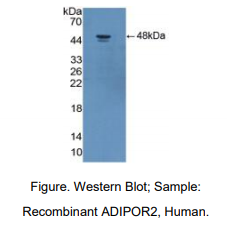 人脂联素受体2(ADIPOR2)多克隆抗体