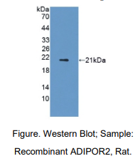 https://msimg.bioon.com/bionline/goods-no-pic.png