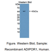 小鼠脂联素受体1(ADIPOR1)多克隆抗体