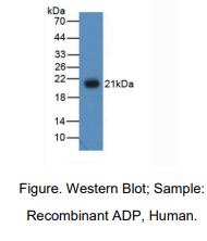 https://msimg.bioon.com/bionline/goods-no-pic.png