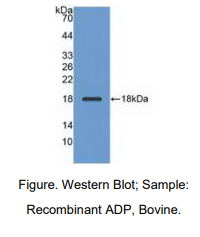 https://msimg.bioon.com/bionline/goods-no-pic.png