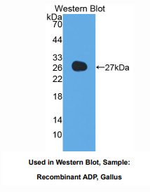 https://msimg.bioon.com/bionline/goods-no-pic.png