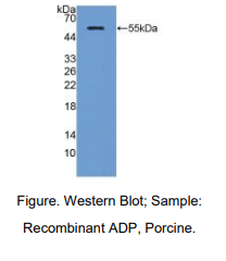 https://msimg.bioon.com/bionline/goods-no-pic.png