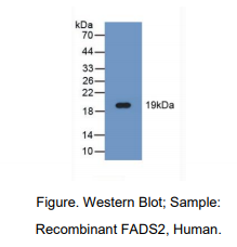 https://msimg.bioon.com/bionline/goods-no-pic.png