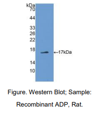 https://msimg.bioon.com/bionline/goods-no-pic.png