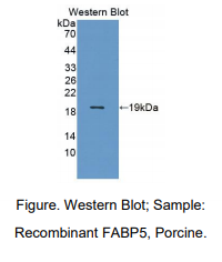 猪脂肪酸结合蛋白5(FABP5)多克隆抗体
