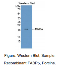 https://msimg.bioon.com/bionline/goods-no-pic.png