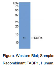 https://msimg.bioon.com/bionline/goods-no-pic.png