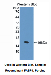 猪脂肪酸结合蛋白1(FABP1)多克隆抗体