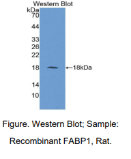 https://msimg.bioon.com/bionline/goods-no-pic.png