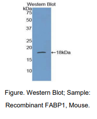 小鼠脂肪酸结合蛋白1(FABP1)多克隆抗体