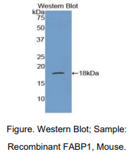 https://msimg.bioon.com/bionline/goods-no-pic.png