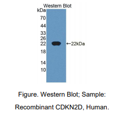 https://msimg.bioon.com/bionline/goods-no-pic.png