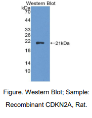 大鼠周期素依赖性激酶抑制因子2A(CDKN2A)多克隆抗体