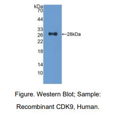 人周期素依赖性激酶9(CDK9)多克隆抗体