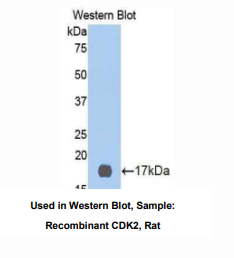 大鼠周期素依赖性激酶2(CDK2)多克隆抗体