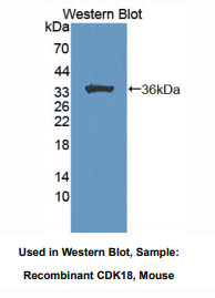 https://msimg.bioon.com/bionline/goods-no-pic.png