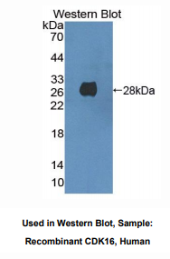 人周期素依赖性激酶16(CDK16)多克隆抗体