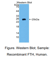 https://msimg.bioon.com/bionline/goods-no-pic.png