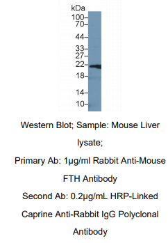 https://msimg.bioon.com/bionline/goods-no-pic.png