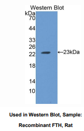 大鼠重肽铁蛋白(FTH)多克隆抗体