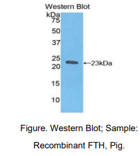 https://msimg.bioon.com/bionline/goods-no-pic.png